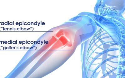 Smerter i underarmen